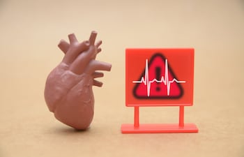 Concepto de salud cardiovascular.
