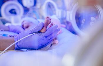 Imagen ilustrativa de un bebé en una incubadora. La mayoría de los siameses nacidos en Paraguay perdieron la vida antes o después de la cirugía de separación.