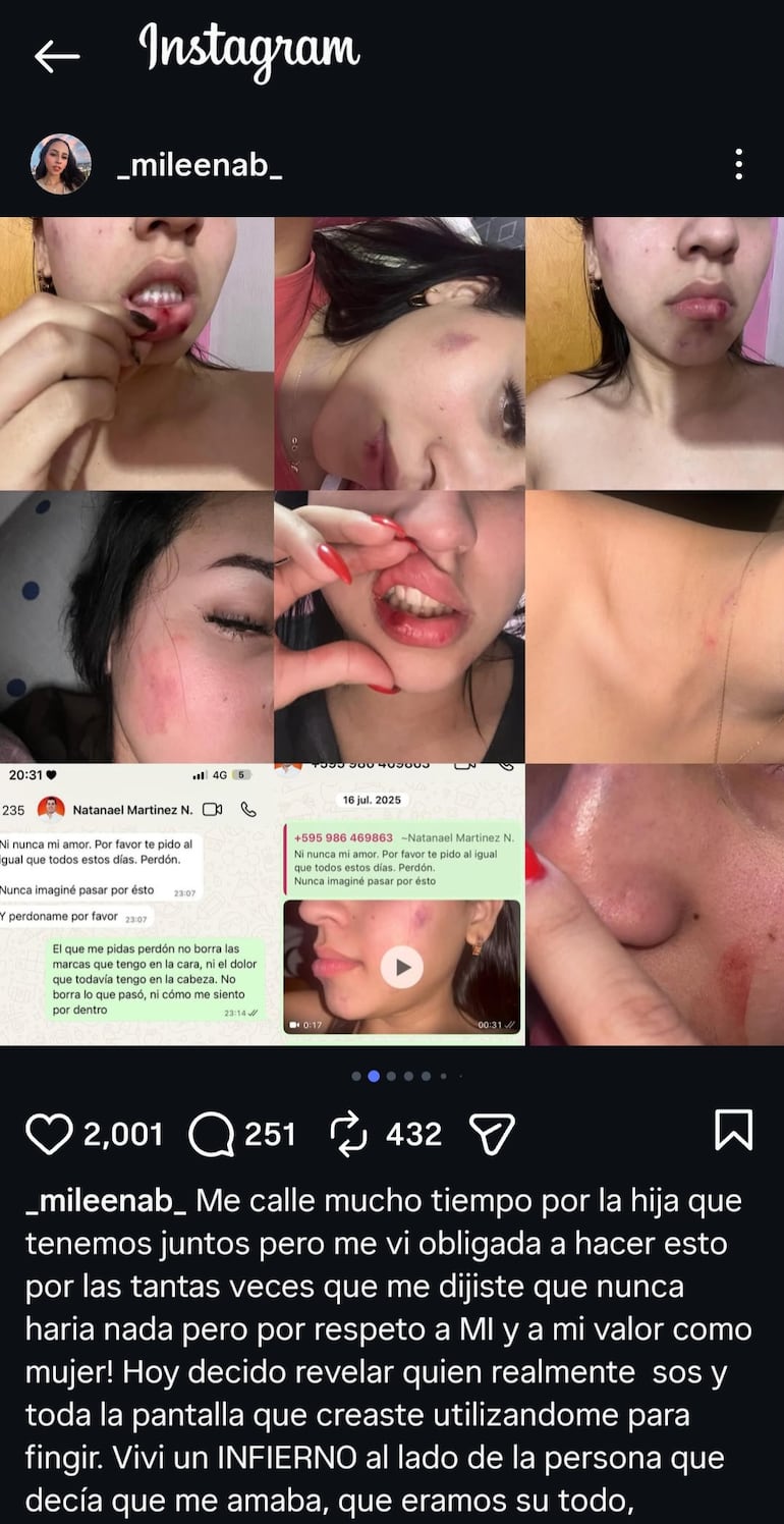 Publicación realizada por Milena Paez, donde realiza la denuncia y exhibe las veces que fue agredida por su expareja.
