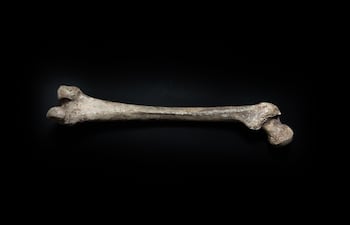Fémur, imagen ilustrativa.