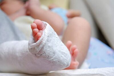 “Pie Bot”, se trata de una anomalía congénita, que ya puede ser diagnosticada con ecografías prenatales. Se caracteriza por la posición torcida, inclinada hacia abajo y adentro de uno o ambos pies. Los músculos y huesos afectados pueden corregirse y una de las técnicas más utilizadas es el método Ponseti.