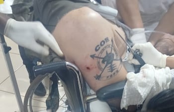 Jefe policial del GEO fue atacado mientras custodiaba un inmueble recientemente liberado tras una ocupación ilegal.