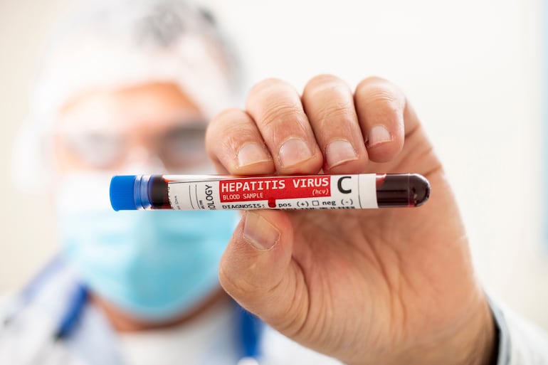 Concepto de hepatitis c.