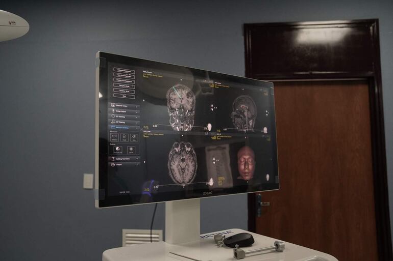 Monitor médico mostrando imágenes de resonancia magnética del cerebro y una reconstrucción 3D de un rostro humano.