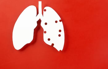 Día Mundial de la Tuberculosis.