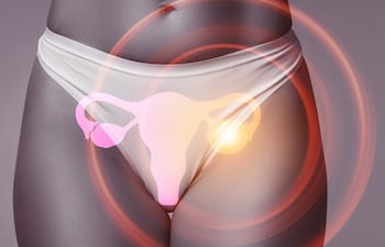 Concepto de salud ovárica.