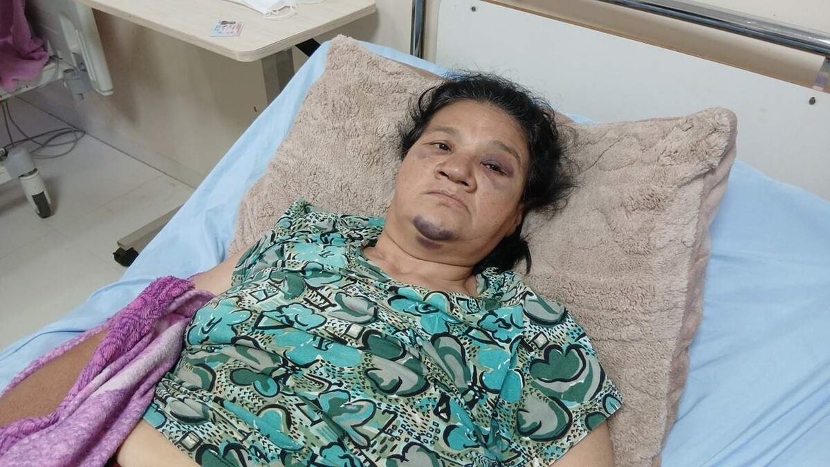 San Juan Bautista: víctima de asalto pide justicia tras ser atacada por adolescente