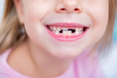 Concepto de dientes de leche.