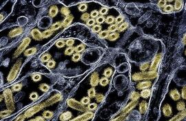 Micrográfico a color de partículas del virus de la gripe aviar H5N1.