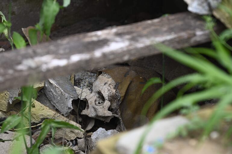 Un cráneo a la vista en una fosa abierta en el cementerio.