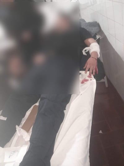 Ambiente hospitalario con dos personas en camilla; una con herida vendada y manchas de sangre en la ropa.