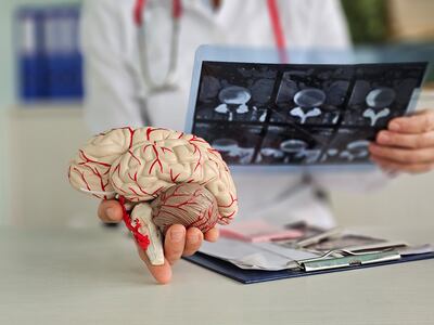 Un médico examina una radiografía cerebral mediante gammagrafía del segmento ST. Resonancia magnética cerebral. Electroneuromiografía. Causas, síntomas y tratamiento de las enfermedades cerebrales.
