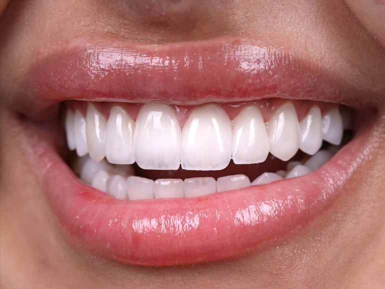 ¿Qué dice el color de tus dientes sobre tu salud?