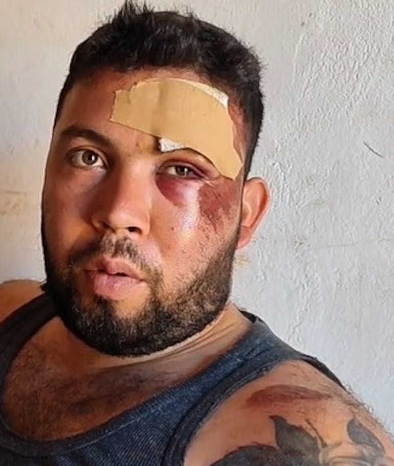 Manuel Amarilla, sufrió lesiones en varias partes del cuerpo.