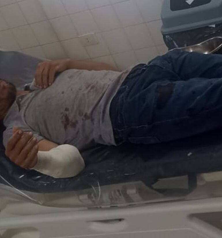 Hermano de un concejal de Alto Verá sindicado como presunto autor de ataque con arma de fuego a un poblador local