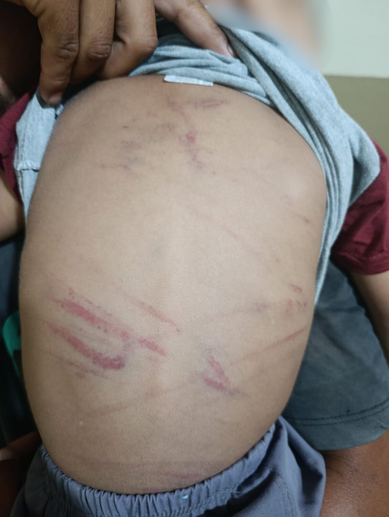 Estas son las heridas que produjeron los golpes que recibió el niño.