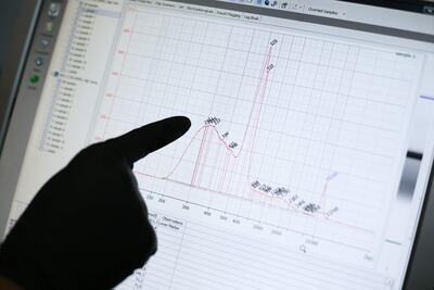 Imagen del 24 de agosto de 2021 de un gráfico que muestra el análisis de muestras de variantes del coronavirus, en el Laboratorio de Diversidad y Enfermedades Virales de la Universidad Federal de Río de Janeiro (Brasil). Encendió las alarmas de las autoridades en todo el mundo por su alta capacidad de contagio y en pocos meses se convirtió en la variante dominante en el mundo, sin embargo, la delta se mantiene hasta ahora como un fenómeno minoritario en gran parte de los países de Latinoamérica. (EFE)