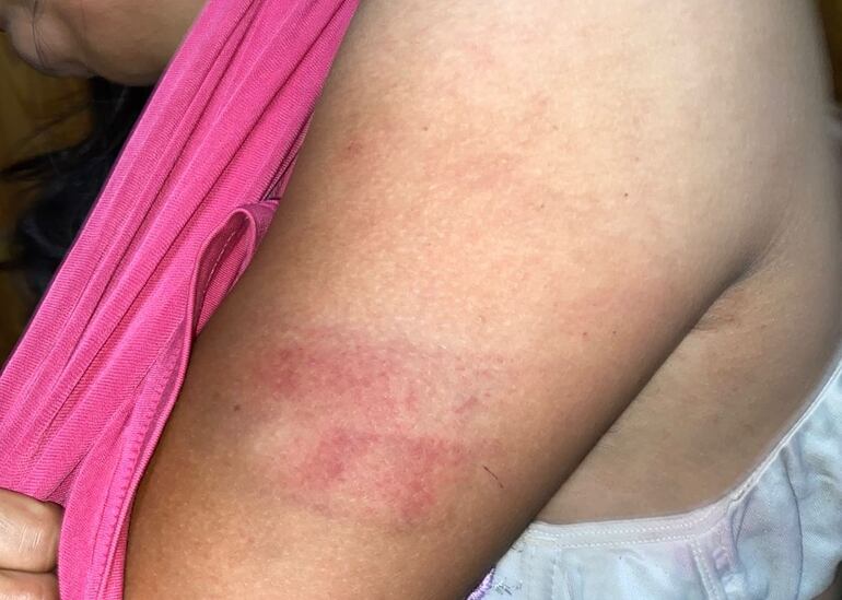 Heridas en el cuerpo de la víctima.