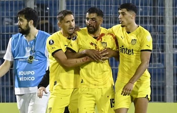 Maximiliano Olivera (c), futbolista de Peñarol, con sangre en el rostro después de recibir un piedrazo al finalizar el partido ante Rosario Central por la Copa Libertadores 2024 en el estadio Gigante de Arroyito, en Rosario, Argentina.