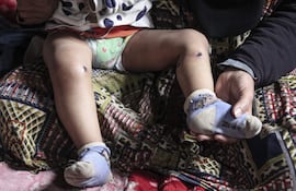Un bebé gazatí sufre heridas y una quemadura de cigarrillo tras ser retenido por Israel