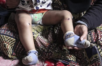 El bebé gazatí Jawad conoce a su corta edad lo que implica vivir bajo una ocupación militar: disparos del Ejército israelí, la detención de su padre y la suya y, según el relato de familiares y documentos médicos, el maltrato físico a manos de soldados.