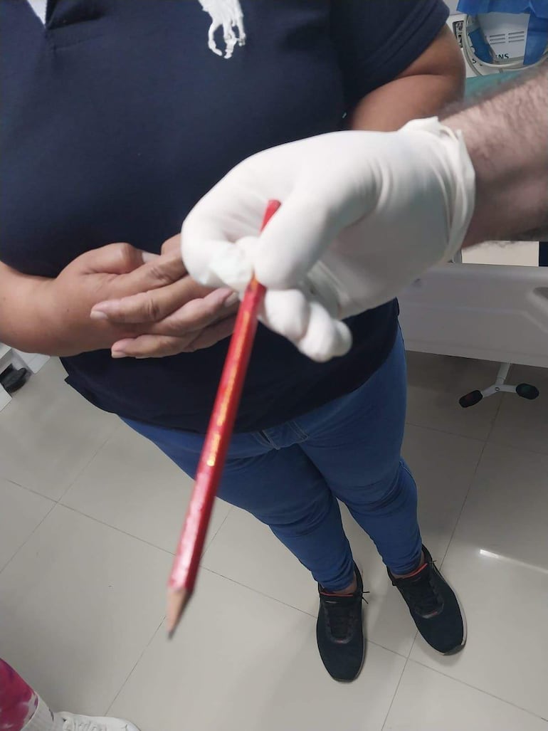 Una “broma” en una escuela terminó con un niño con perforación intestinal