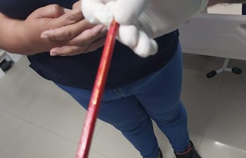 Un personal médico sostiene el lápiz que le ocasionó el grave daño a un niño.