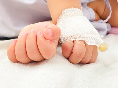 Manos de un bebé recibiendo suero.