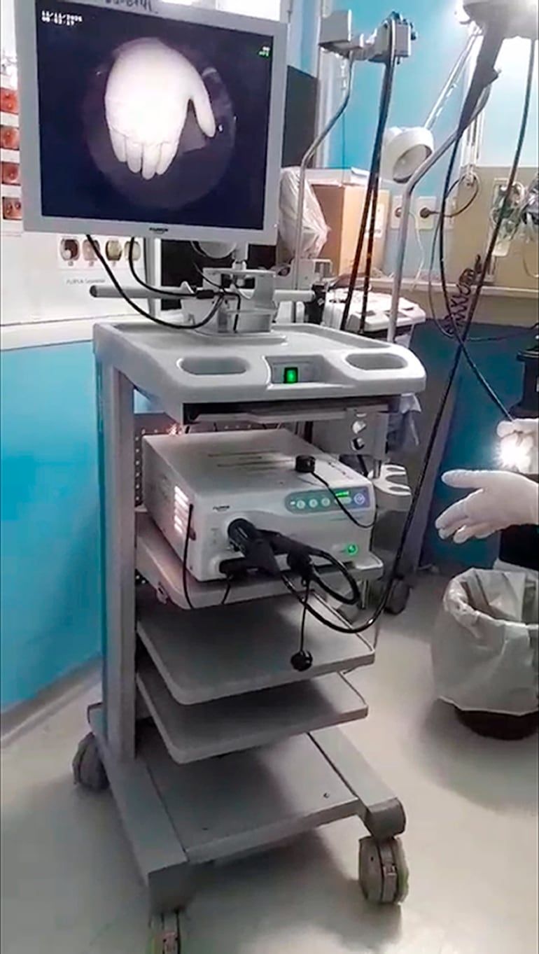 Escándalo en el Incan: detectan segundo equipo médico “carneado”