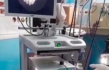 Torre de Broncospocía del Incan que se retiró del hospital para su traslado al Ineram. El Ministerio de Salud afirmó que fue carneado y se encuentra en la empresa representante.