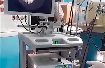 Equipo de video fibrobroncoscopio del Incan.