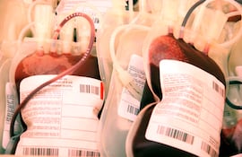 donación de volúmenes de sangre para trasfusión