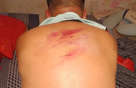 El pastor Nicolás González Manzoni, quedó con varias lesiones a raíz de la pelea que mantuvo con los delincuentes.