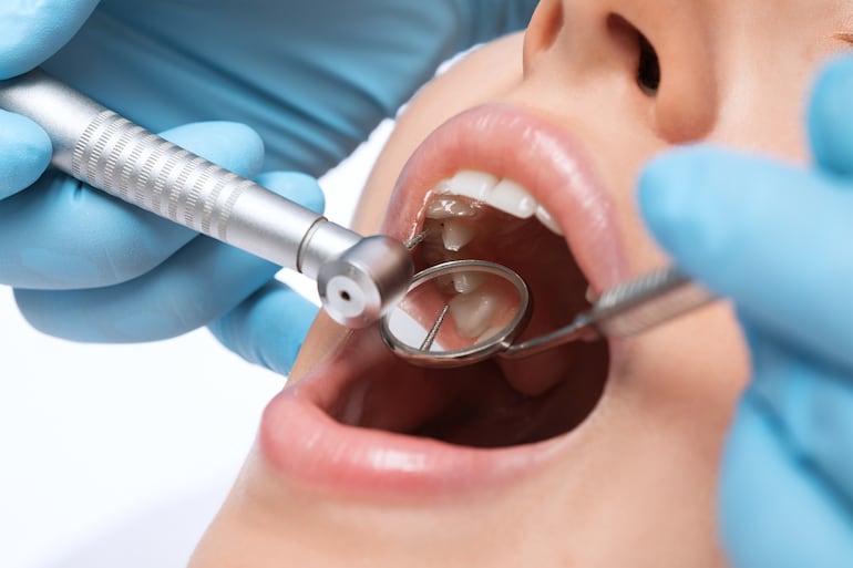 Concepto de cuidado de los dientes, caries, higiene dental.