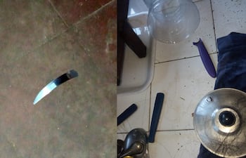 Evidencias del brutal ataque en Mbocayaty del Guairá sufrido por Fanny Lorena Toledo a manos de su esposo, Hugo Ever Figueredo Amarilla, que ya cuenta con antecedentes por violencia familiar con una expareja.