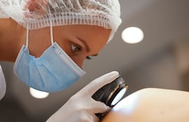Dermatólogo examina la piel de una persona.