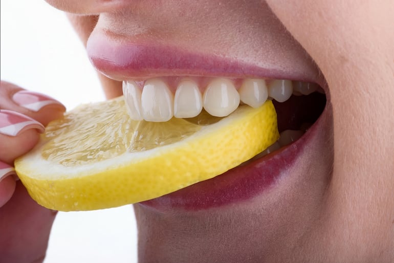 Qué pasa realmente cuando usás blanqueadores dentales sin control.