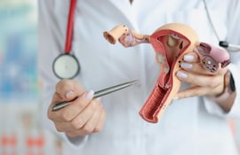 Las manos del médico sostienen un modelo seccional de los órganos reproductivos femeninos.