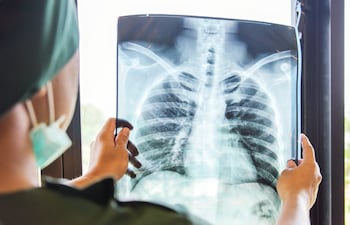 Una imagen de referencia sobre un profesional analizando una radiografía.