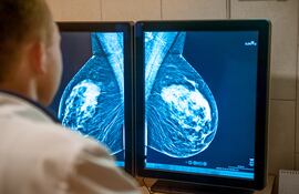 Un médico examina una mamografía.