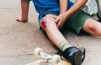 Una simple caída puede significar la pérdida de mucha sangre para una persona hemofílica.