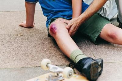 Una simple caída puede significar la pérdida de mucha sangre para una persona hemofílica.