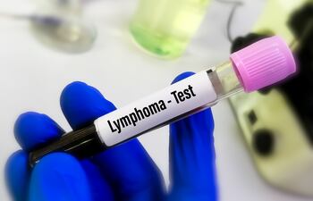 Existen dos tipos principales de linfomas desde el punto de vista histológico: Linfoma de Hodgkin y Linfoma no Hodgkin.