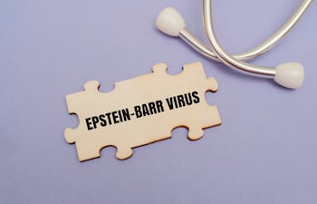 Virus de Epstein-Barr.