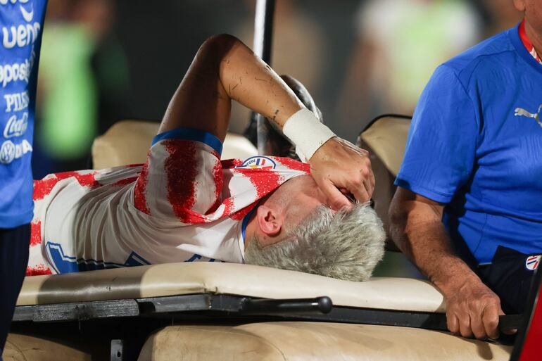 Julio Enciso (c) de Paraguay reacciona este viernes, en un partido amistoso entre Paraguay y Nicaragua previo a la Copa Mundial de Fútbol 2026 en el estadio Defensores del Chaco en Asunción.