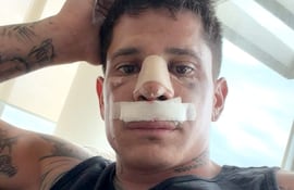 Juan Manuel Iturbe Arévalos (04/06/1993), delantero de Cerro Porteño, después de su operación.