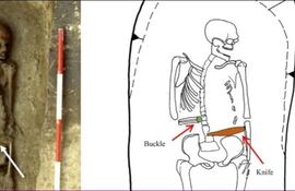 Descubren en Italia el caso de un hombre medieval con un cuchillo en lugar de mano