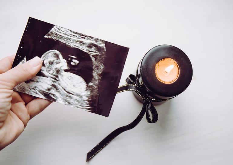 Día de las Pérdidas Gestacionales y Neonatales: qué decir y qué evitar con quien perdió un embarazo.