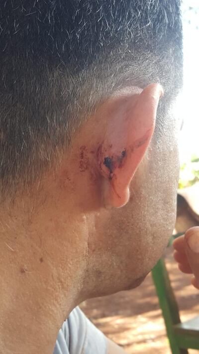 Corazón Zacarías sufrió una herida en la oreja durante el allanamiento.