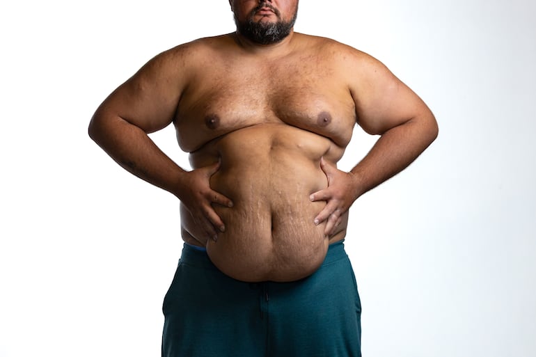 Los medicamentos están cambiando la salud cardíaca en adultos con obesidad - Ciencia